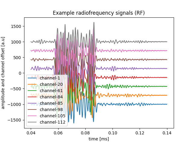 Example radiofrequency signals (RF)